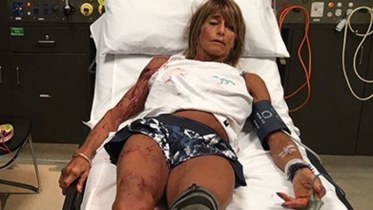 Debbie Urquhart after the kangaroo attack on Saturday. Photo: Supplied 