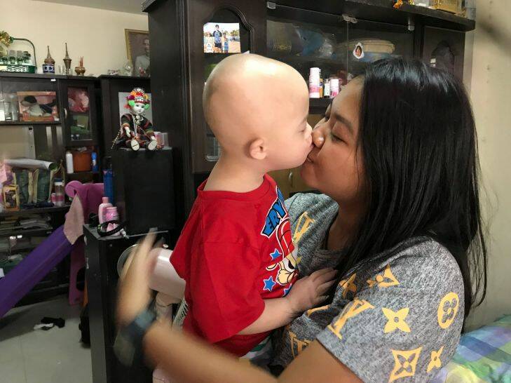 Gammy gets a birthday kiss from his mother Pattaramon "Goy" Chanbua in the family's house south-east of Bangkok that bought with donations from Australia. Photo by Am Sandford SUPPLIED by Lindsay Murdoch THE AGE NEWS wORLD 23rd December 2017