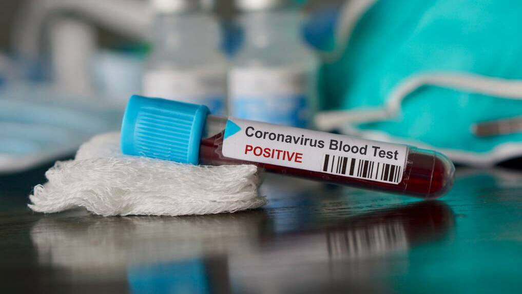 First coronavirus case confirmed in Wimmera