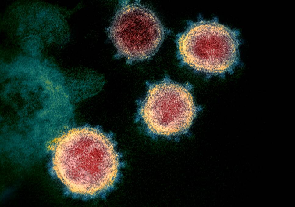 A microscope image shows SARS-CoV-2, the coronavirus strain that causes COVID-19. Picture: Wikipedia/ NIAID Rocky Mountain Laboratories.