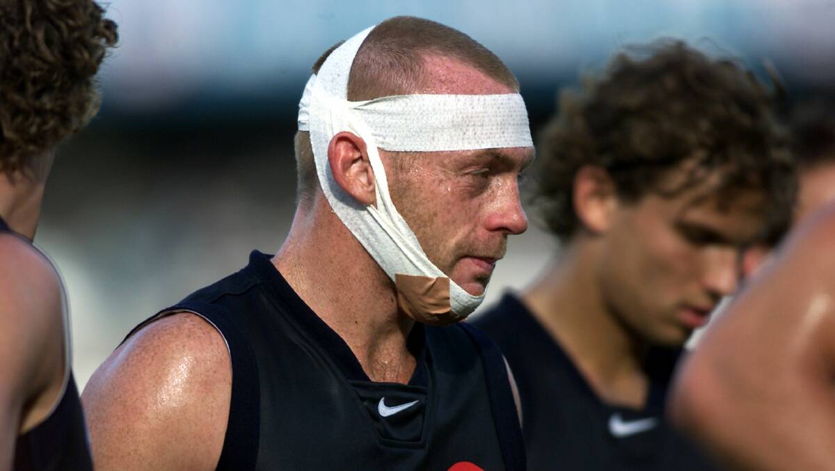 2002 Round 4 - Carlton versus Port Adelaide. Carlton's Adrian Hickmott departs Football Park at the end of the game with jaw injury. Picture: Bryan Charlton