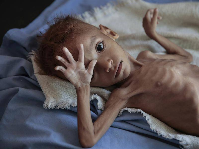 More than 80,000 children in Yemen have died from starvation, charity Save the Children says.